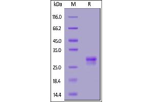 Human TL1A, His Tag on  under reducing (R) condition. (TNFSF15 Protein (AA 72-251) (His tag))