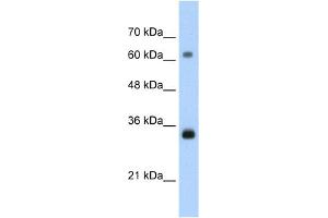 WB Suggested Anti-PCNA Antibody Titration:  1.
