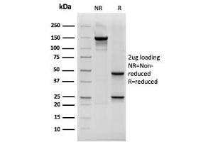 SDS-PAGE Analysis Purified CK19 Mouse Recombinant Monoclonal Antibody (rKRT19/800). (Rekombinanter Cytokeratin 19 Antikörper)