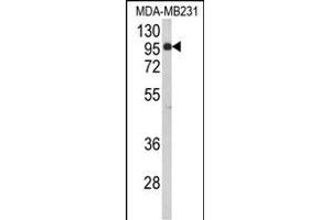 Western blot analysis of BAHD1 Antibody (C-term) (ABIN653104 and ABIN2842693) in MDA-M cell line lysates (35 μg/lane). (BAHD1 Antikörper  (C-Term))