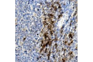 IHC analysis of CD8 alpha/Cd8a using anti-CD8 alpha/Cd8a antibody (ABIN7601570). (CD8 alpha Antikörper  (AA 39-245))