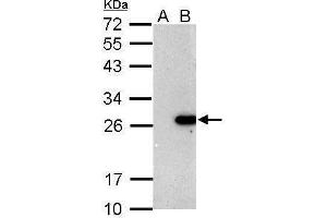 WB Image Sample (30 ug of whole cell lysate) A: Non-transfected 293T lysates B: BCL2 transfected 293T lysate 12% SDS PAGE antibody diluted at 1:5000 (Bcl-2 Antikörper)