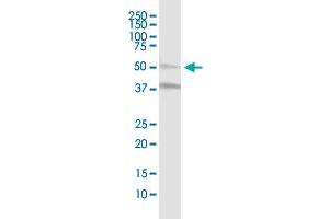 MLKL MaxPab polyclonal antibody. (MLKL Antikörper  (AA 1-471))