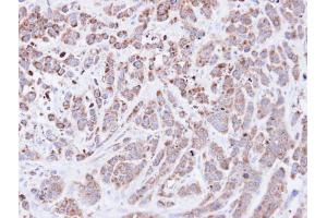 IHC-P Image Immunohistochemical analysis of paraffin-embedded MDA-MB-468 xenograft, using Cyclophilin A, antibody at 1:500 dilution.