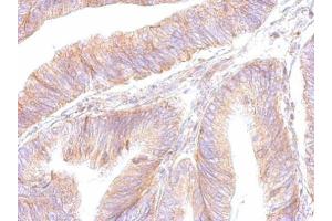 IHC-P Image ATP synthase B1 antibody detects ATP5F1 protein at cytosol on human colon by immunohistochemical analysis. (ATP Synthase B1 (Center) Antikörper)