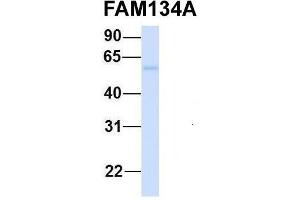 Host:  Rabbit  Target Name:  FAM134A  Sample Type:  Human Fetal Heart  Antibody Dilution:  1. (FAM134A Antikörper  (N-Term))