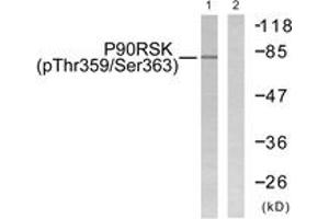 Western blot analysis of extracts from 293 cells treated with PMA 125ng/ml 30', using p90 RSK (Phospho-Thr359+Ser363) Antibody. (RPS6KA3 Antikörper  (pThr359))