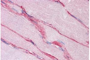Human Skeletal Muscle: Formalin-Fixed, Paraffin-Embedded (FFPE) (SGCB Antikörper  (AA 87-197))