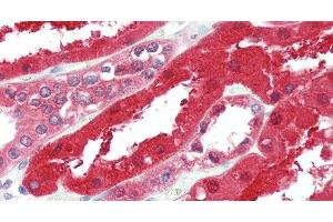 Immunohistochemistry of paraffin-embedded Kidney tissue using GPC6 Polyclonal Antibody at dilution of 1:90. (Glypican 6 Antikörper)