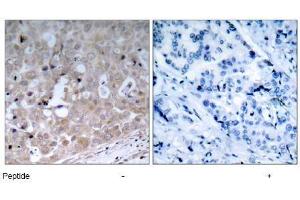 Image no. 1 for anti-VEGF Receptor 2 (VEGFR2) (Tyr1175) antibody (ABIN197236)