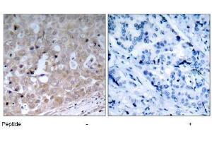 Image no. 1 for anti-VEGF Receptor 2 (VEGFR2) (Tyr1175) antibody (ABIN197237) (VEGFR2/CD309 Antikörper  (Tyr1175))