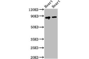Western Blot Positive WB detected in: Rat heart tissue, Mouse heart tissue All lanes: ACO2 antibody at 2. (ACO2 Antikörper  (AA 452-676))
