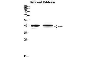 Western Blot (WB) analysis of Rat Heart and Rat Brain using Cerberus Polyclonal Antibody diluted at 1:500. (CER1 Antikörper  (Internal Region))