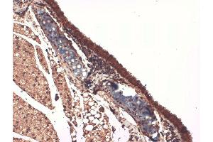 Immunohistochemistry (IHC) image for anti-Solute Carrier Family 5 (Sodium/iodide Cotransporter), Member 5 (SLC5A5) (AA 468-643) antibody (PerCP) (ABIN2484444)