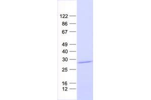 Chromosome 21 Open Reading Frame 62 (C21orf62) protein (His tag)