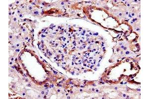 Immunohistochemistry of paraffin-embedded human kidney tissue using ABIN7173365 at dilution of 1:100 (TRIB3 Antikörper  (AA 152-325))