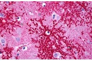 Anti-SLC1A2 / EAAT2 antibody IHC staining of human brain, astrocytes.