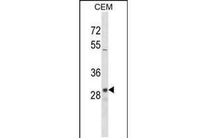 Western blot analysis in CEM cell line lysates (35ug/lane). (OR1D2 Antikörper  (C-Term))