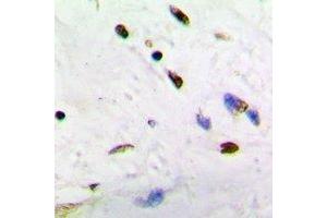 Immunohistochemical analysis of ADNP staining in human brain formalin fixed paraffin embedded tissue section. (ADNP Antikörper  (N-Term))