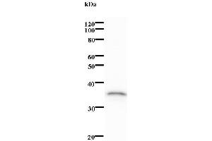 anti-Epstein-Barr Virus Nuclear Antigen-2 (EBNA-2) antibody
