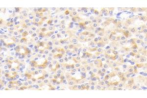 Detection of CIDEC in Rat Stomach Tissue using Polyclonal Antibody to Cell Death Inducing DFFA Like Effector C (CIDEC) (CIDEC Antikörper  (AA 1-221))