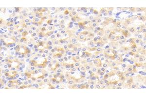 Detection of CIDEC in Rat Stomach Tissue using Polyclonal Antibody to Cell Death Inducing DFFA Like Effector C (CIDEC)