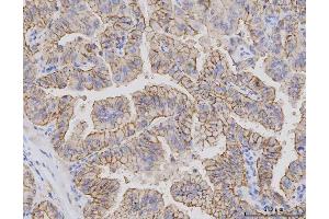 IHC analysis of Claudin 3/CLDN3 using anti-Claudin 3/CLDN3 antibody (ABIN7599625). (Claudin 3 Antikörper  (AA 101-220))