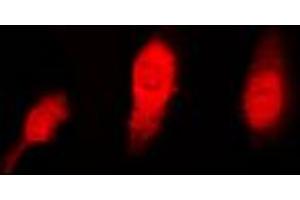 Immunofluorescent analysis of Histone Deacetylase 6 staining in HeLa cells.