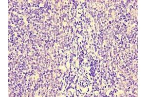 Immunohistochemistry of paraffin-embedded human lymph node tissue using ABIN7155534 at dilution of 1:100 (HCP5 Antikörper  (AA 8-101))
