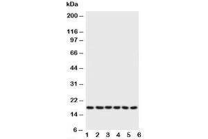 Western blot testing of Phospholamban antibody and Lane 1:  rat heart;  2: rat heart;  3: CEM;  4: MCF-7;  5: HT1080;  6: HeLa;  Predicted size: 18KD;  Observed size: 18KD (Phospholamban Antikörper  (N-Term))