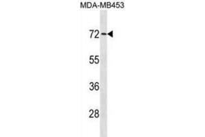 Western Blotting (WB) image for anti-Mex-3 Homolog C (C. Elegans) (MEX3C) antibody (ABIN3001399) (MEX3C Antikörper)