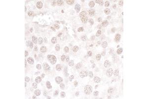 Immunohistochemistry (IHC) image for anti-hPrp3p (AA 100-150) antibody (ABIN7453461) (hPrp3p (AA 100-150) Antikörper)