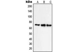 Western blot analysis of NHE9 expression in HepG2 (A), Caco2 HeLa (B), NIH3T3 (C) whole cell lysates. (SLC9A9 Antikörper  (Center))