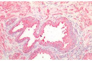 Detection of NOTCH2NL in Human Prostate Tissue using Polyclonal Antibody to Notch2 N-Terminal Like Protein (NOTCH2NL) (NOTCH2NL Antikörper  (AA 1-236))