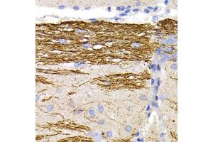Immunohistochemistry of paraffin-embedded rat brain using NEFL antibody. (NEFL Antikörper)