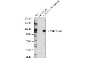 Immunoprecipitation analysis of 200 μg extracts of HeLa cells, using 3 μg Phospho-p90Rsk/RSK1/RPS6K-S380 pAb (ABIN6135275, ABIN6136172, ABIN6136173 and ABIN6225586). (RPS6KA1 Antikörper  (pSer380))