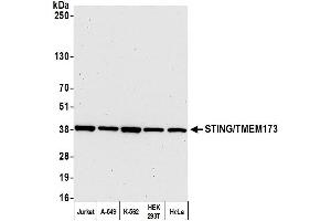 Western Blotting (WB) image for anti-Transmembrane Protein 173 (TMEM173) (AA 329-379) antibody (ABIN7449665)