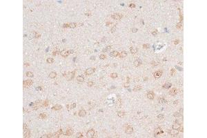 Immunohistochemistry (Paraffin-embedded Sections) (IHC (p)) image for anti-Cadherin 18, Type 2 (CDH18) antibody (ABIN7258012)