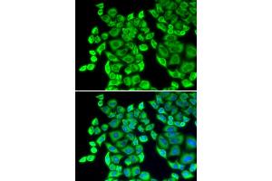 Immunofluorescence analysis of U2OS cells using EEF1D antibody (ABIN5971342). (EEF1D Antikörper)