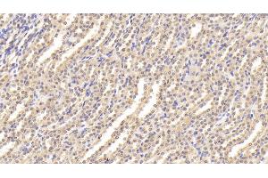 Detection of ESM1 in Rat Kidney Tissue using Polyclonal Antibody to Endothelial Cell Specific Molecule 1 (ESM1) (ESM1 Antikörper  (AA 22-184))