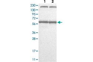 Western Blot analysis with KPNA6 polyclonal antibody  Lane 1: Human cell line RT-4 Lane 2: Human cell line U-251MG sp (KPNA6 Antikörper)