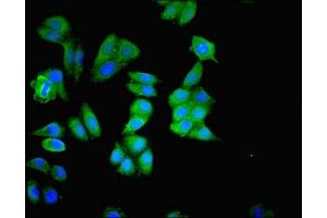 Immunofluorescence staining of HepG2 cells with ABIN7159999 at 1:200, counter-stained with DAPI. (ERK1 Antikörper  (AA 11-379))