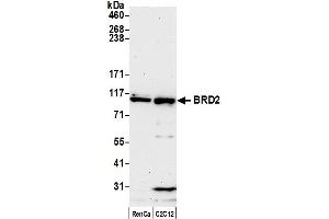 Western Blotting (WB) image for anti-Bromodomain Containing 2 (BRD2) (AA 675-725) antibody (ABIN7453879) (BRD2 Antikörper  (AA 675-725))
