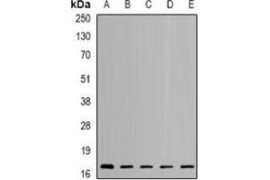 Western blot analysis of NUDT2 expression in SKOV3 (A), HL60 (B), mouse kidney (C), mouse brain (D), rat heart (E) whole cell lysates.