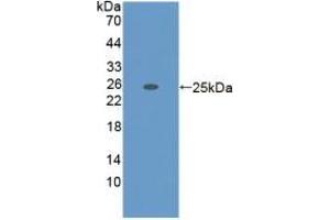 Detection of Recombinant ADAMTS7, Mouse using Polyclonal Antibody to A Disintegrin And Metalloproteinase With Thrombospondin 7 (ADAMTS7) (ADAMTS7 Antikörper  (AA 226-437))