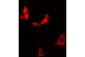 ABIN6269375 staining HeLa cells by IF/ICC.