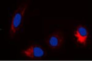 Immunofluorescent analysis of TAU (pS356) staining in Hela cells. (tau Antikörper  (pSer356, pSer673))