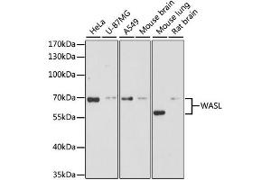 Western blot analysis of extracts of various cell lines, using WASL antibody (ABIN1875345) at 1:3000 dilution. (Neural Wiskott-Aldrich syndrome protein (WASL) Antikörper)