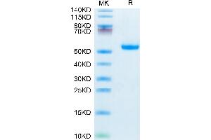 IL5RA Protein (AA 18-339) (His tag)