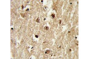 Immunohistochemistry (IHC) image for anti-Insulin-Like Growth Factor Binding Protein 2, 36kDa (IGFBP2) (AA 277-305) antibody (ABIN3031351)